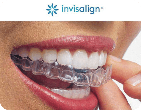 Invisalign Treatment Certified Providers